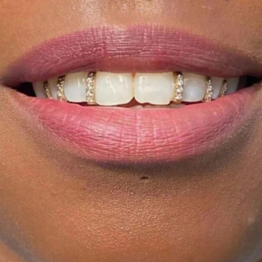 ShopGomad Tooth Cuff (Grill) with Vertical Gold Bar Hip Hop Teeth Grillz  l TEETH CUFF 🦷